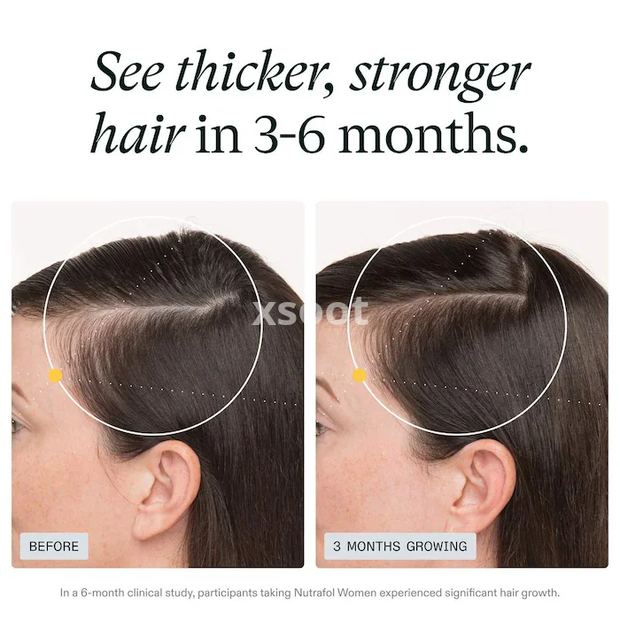 Buy Women’s Clinically Proven Hair Growth Supplement
