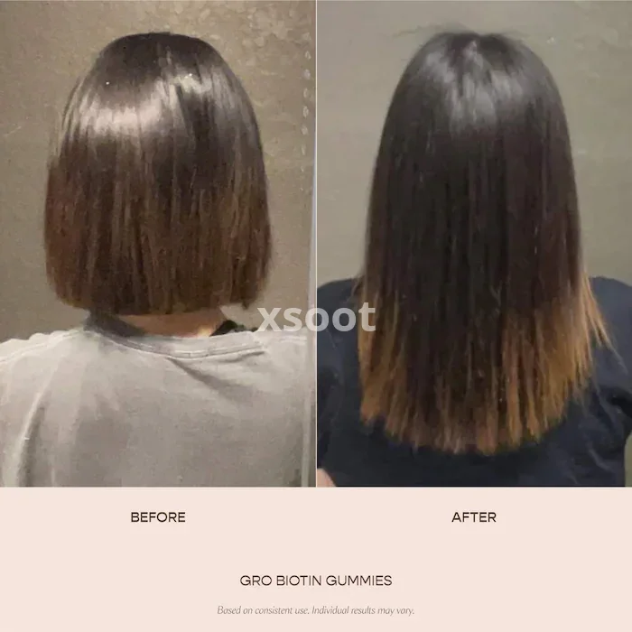 Buy GRO Biotin Gummies for Thinning Hair - Support Growth