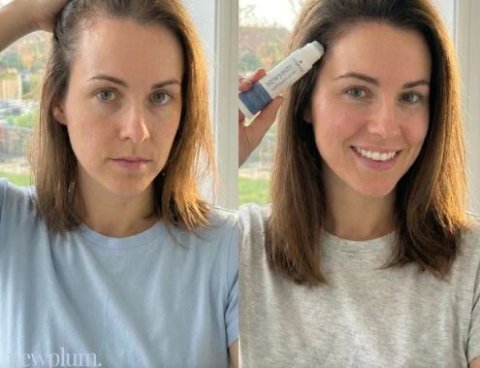 Buy Newplum Advanced Hair Growth Roll-On Serum Online